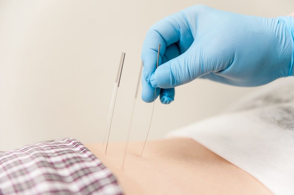 Trattamento dell'osteocondrosi del torace