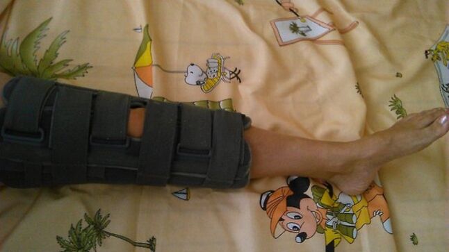 Immobilizzazione dell'articolazione del ginocchio in caso di dolore